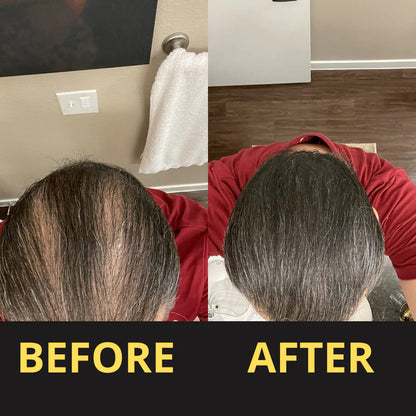 HAIRFILLUP HAIR CONCEALER 50ML - (BLACK/BROWN)