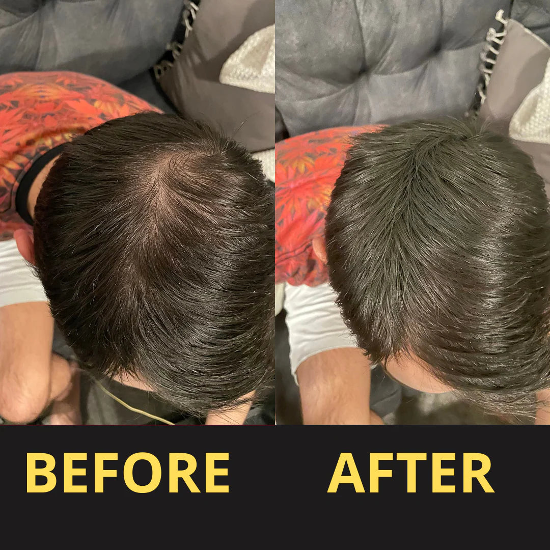 HAIRFILLUP HAIR CONCEALER 50ML - (BLACK/BROWN)