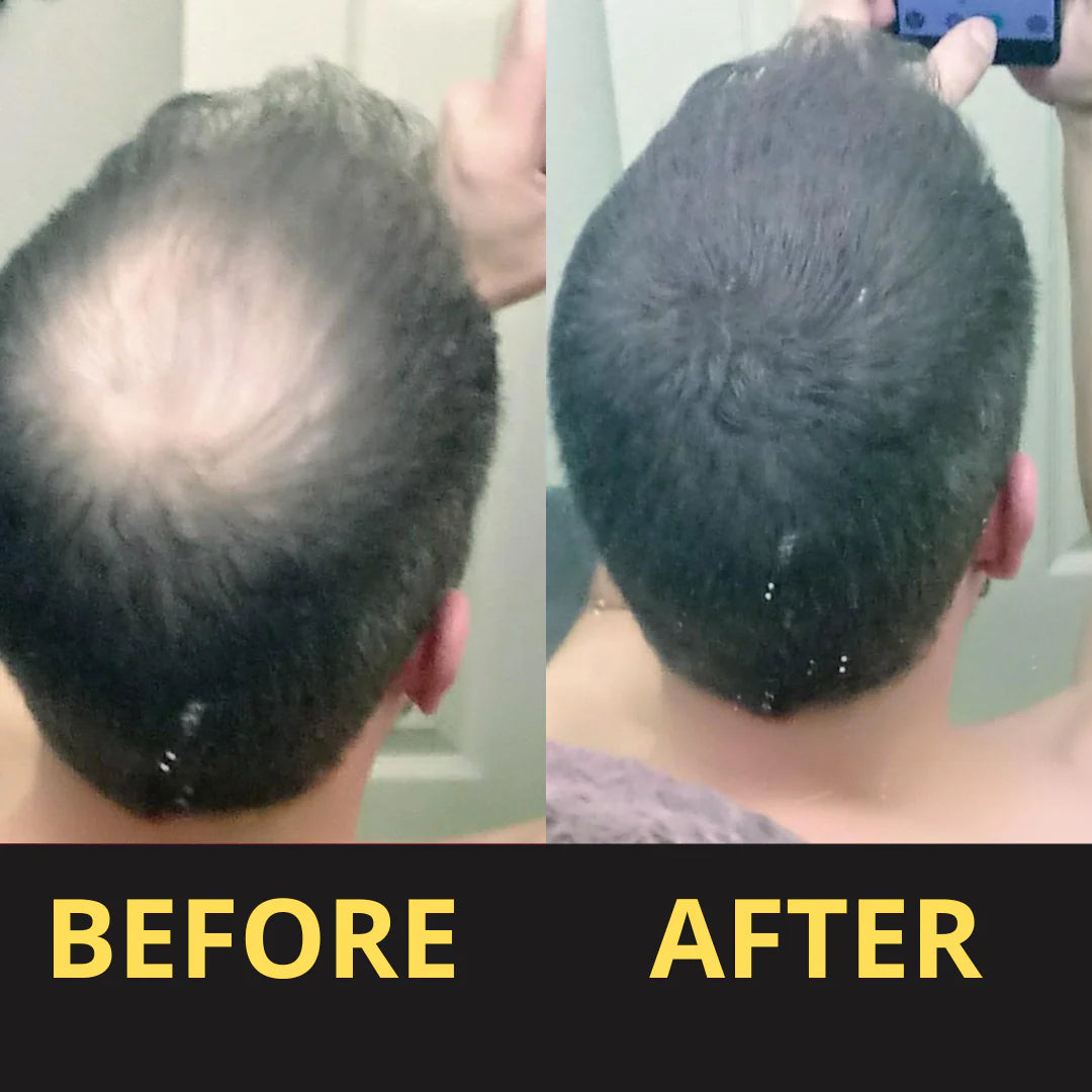 HAIRFILLUP HAIR CONCEALER 50ML - (BLACK/BROWN)