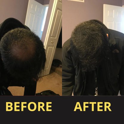 HAIRFILLUP HAIR CONCEALER 50ML - (BLACK/BROWN)