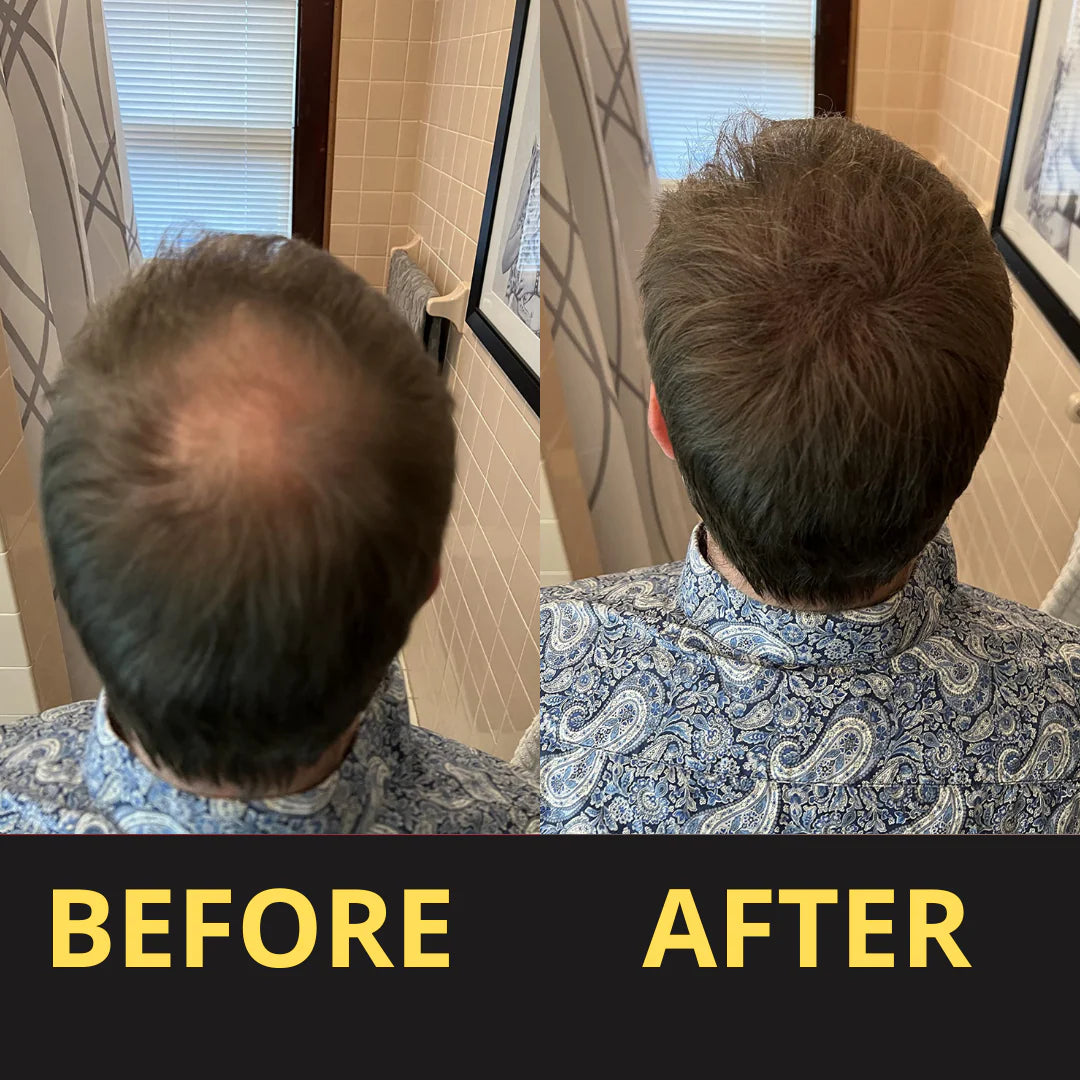 HAIRFILLUP HAIR CONCEALER 50ML - (BLACK/BROWN)