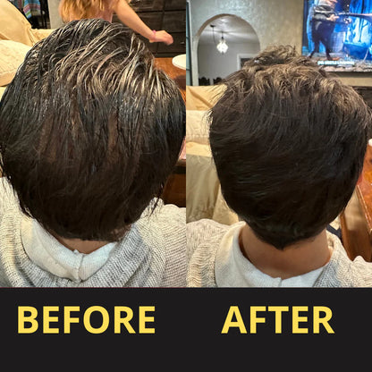 HAIRFILLUP HAIR CONCEALER 50ML - (BLACK/BROWN)