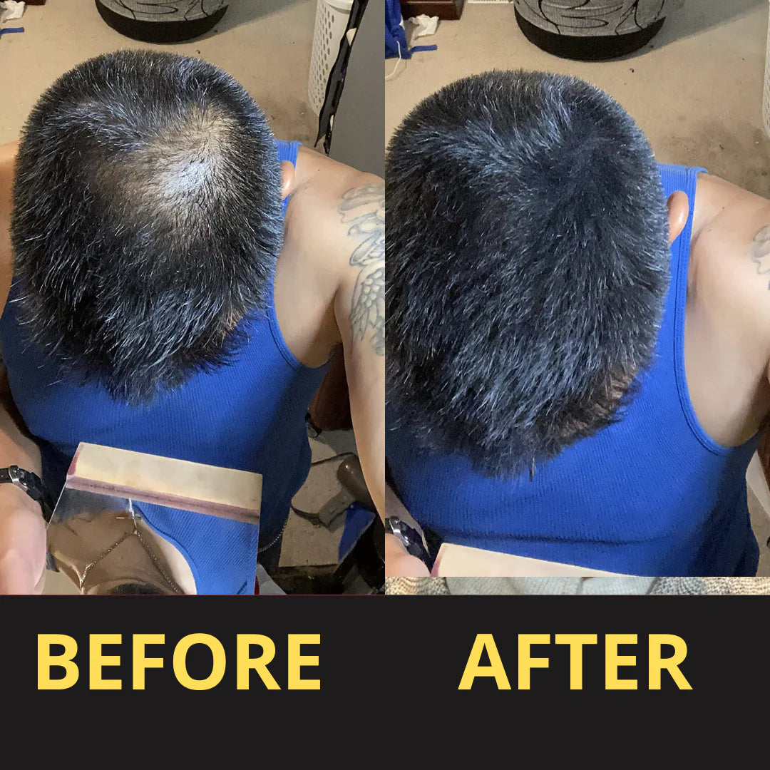 HAIRFILLUP HAIR CONCEALER 50ML - (BLACK/BROWN)