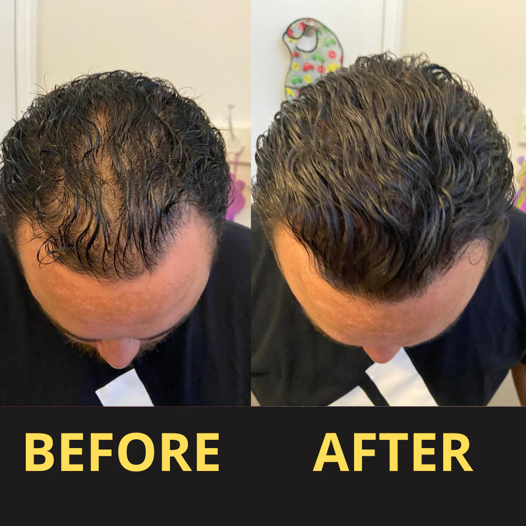 HAIRFILLUP HAIR CONCEALER 50ML - (BLACK/BROWN)