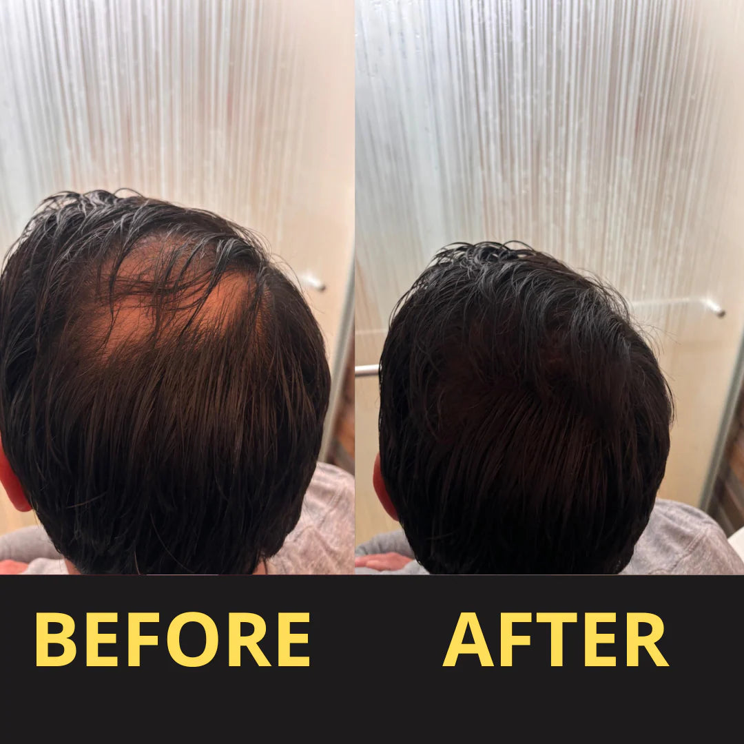 HAIRFILLUP HAIR CONCEALER 50ML - (BLACK/BROWN)