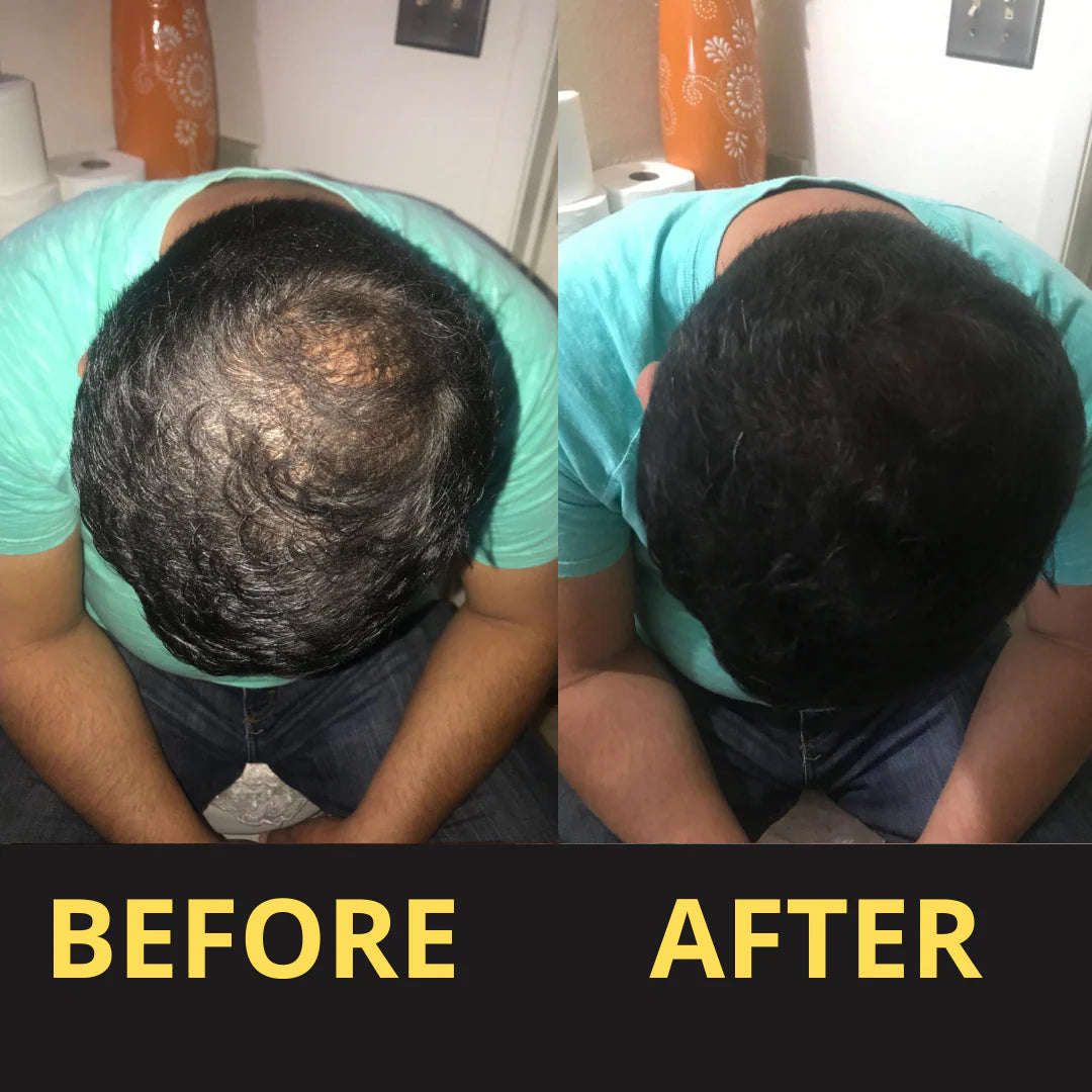 HAIRFILLUP HAIR CONCEALER 50ML - (BLACK/BROWN)