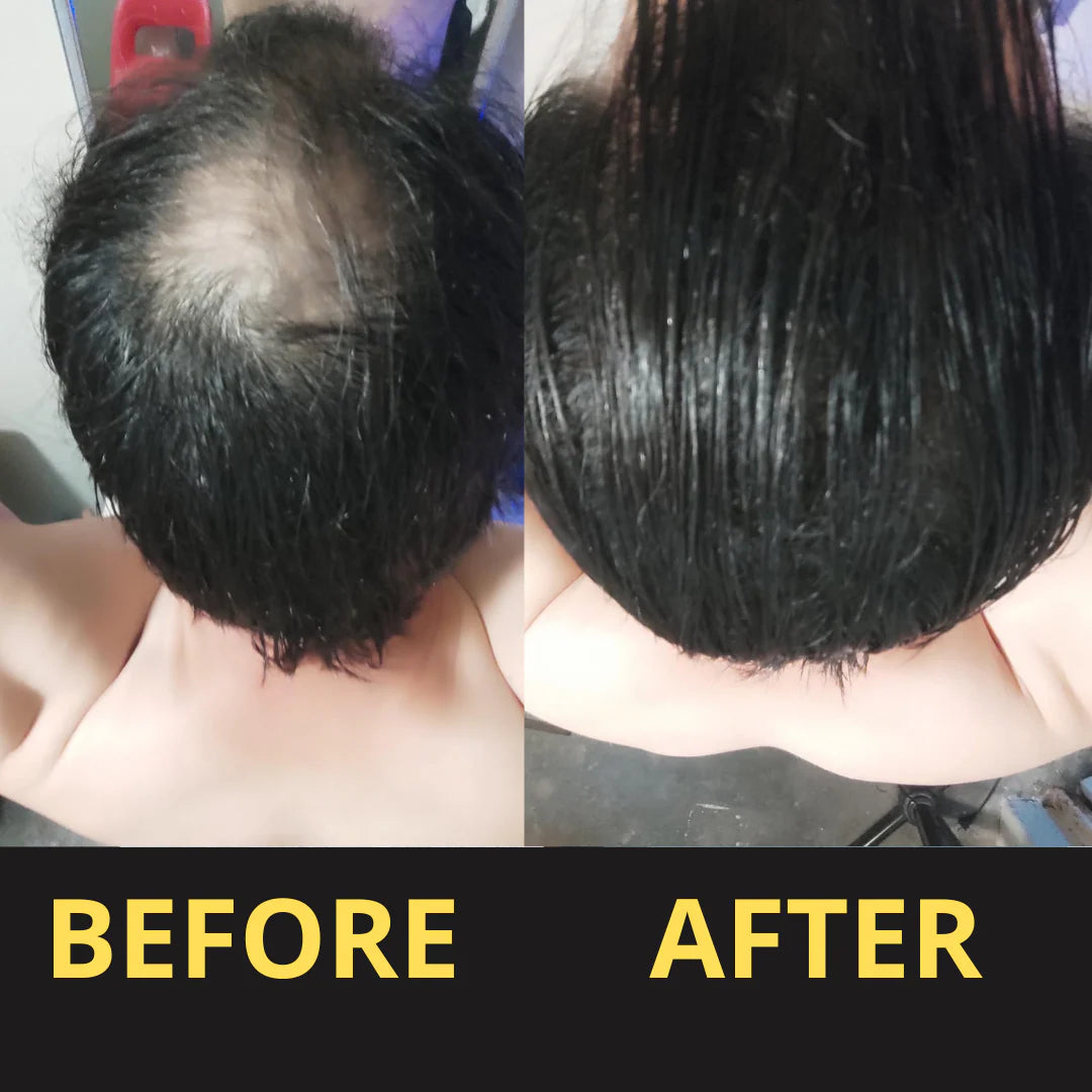 HAIRFILLUP HAIR CONCEALER 50ML - (BLACK/BROWN)