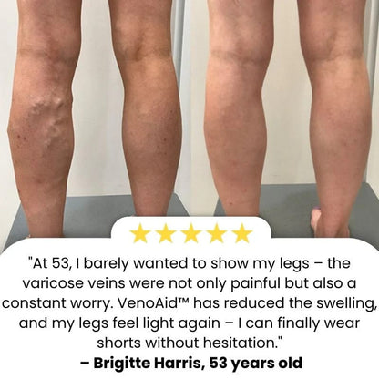 BioEquis Varicose Vein Spray