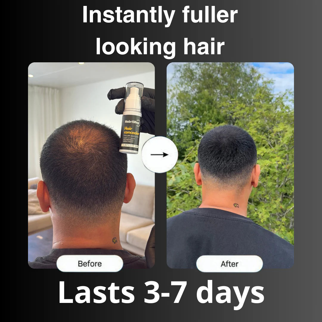 HAIRFILLUP HAIR CONCEALER 50ML - (BLACK/BROWN)