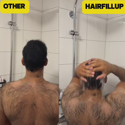 HAIRFILLUP HAIR CONCEALER 50ML - (BLACK/BROWN)